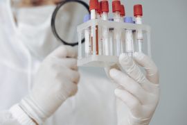 Bio Farma, British firm to develop recombinant factor VIII product