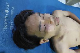 Lima remaja di Sekongkang aniaya pelajar, korban masuk rumah sakit