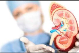 Dokter: Deteksi gangguan ginjal akut dengan monitor minimal 14 hari