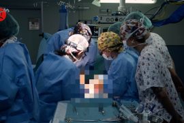 Bayi 13 bulan&nbsp;jalani transplantasi usus dari donor yang meninggal