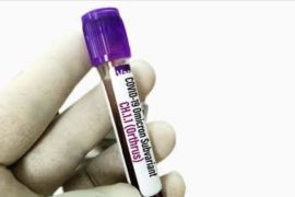 COVID: 34 Orthrus patients in Jakarta recover