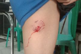 Tiga anak digigit anjing rabies di Dompu NTB