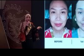 The Clinic Beautyloshopy perkenalkan plastik surgery, satu-satunya di Sumut