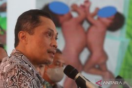 Pra operasi pemisahan bayi kembar Siam di RSSA Malang