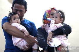 Pemulangan bayi kembar Siam di Malang
