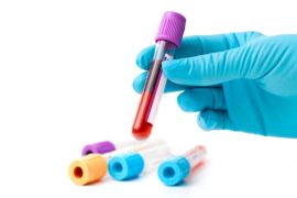 Masyarakat diimbau hindari paparan zat asing cegah kanker darah