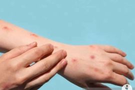 Positive mpox cases reach 29: Official