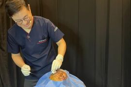 Mengenal teknik 'threadlift' dan 'filler' hyaluronic acid untuk peremajaan