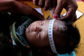 Ini alasan agar orang tua tidak panik ketika hadapi kejang pada anak