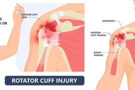 Catat, olahraga tanpa pemanasan bisa picu radang di sendi