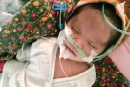 Relawan HST galang dana untuk balita Raihan penyandang jantung bocor