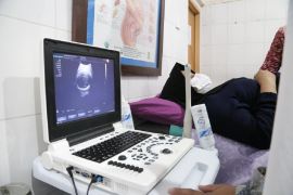 Dinkes imbau masyarakat manfaatkan USG dua dimensi gratis di puskesmas