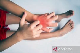 Kenali gejala yang dapat muncul akibat alergi gluten