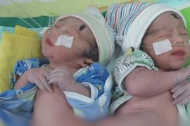 RSUD Tulungagung bentuk tim kembar siam lintasdisiplin