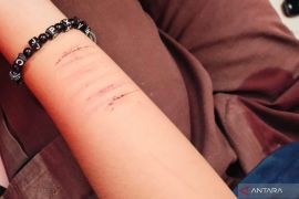 Polisi beri pendampingan siswi korban rudapaksa ayah kandung