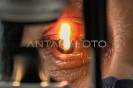 Katarak tidak bisa sembuh hanya dengan obat tetes mata