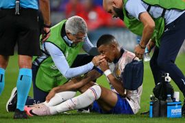 Prancis menang, Mbappe cedera patah tulang hidung