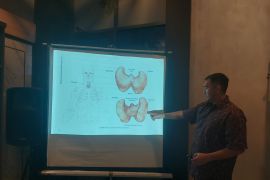 Dokter: Kanker tiroid disebabkan paparan radiasi hingga genetik