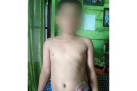 DPRD Kota Medan minta BPJS Kesehatan respon keluhan pasien di RSU Haji