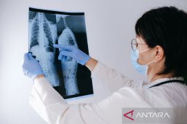 Kanker paru, penyakit mematikan yang bisa dicegah dengan deteksi dini