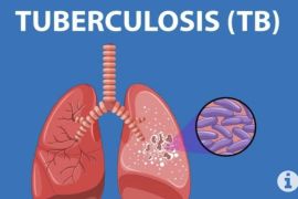 Jepang wajibkan tes TBC untuk warga negara asing yang akan tinggal lebih dari 3 bulan