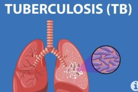 Dinkes catat kasus tuberkulosis di Jakarta capai 21 ribu lebih