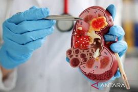 Beberapa ciri ginjal sehat dan ginjal yang sakit menurut dokter