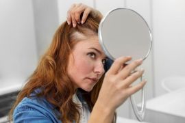 FDA peringatkan efek samping serius dari obat penumbuh rambut populer di AS