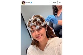 Kecelakaan mobil di AS, Aurelie Moeremans masih derita efek gegar otak