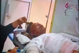 Seorang pekerja pabrik sawit PT BSS alami kecelakaan kerja hingga dirujuk ke RS M Djamil Padang