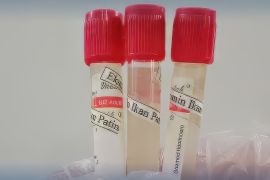 DKP Kalsel kembangkan ekstrak Albumin ikan Patin dan Kembung