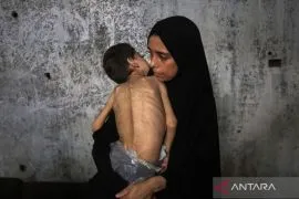 Seberapa parah bencana kelaparan di Gaza?
