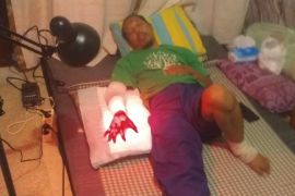 Tangan seorang anggota Linmas Petojo harus diamputasi setelah di bacok pelaku tawuran