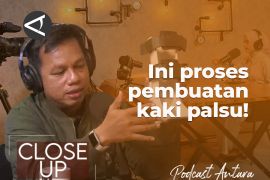 Proses di balik pembuatan kaki palsu (2)