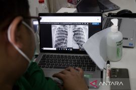 Skrining TBC di lapas Indramayu