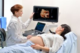 Hari Ibu, POGI gaungkan pentingnya deteksi dini kehamilan dengan teknologi Mindray