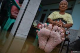 Warga terdampak banjir di Tangerang kesulitan air bersih dan mulai terserang penyakit