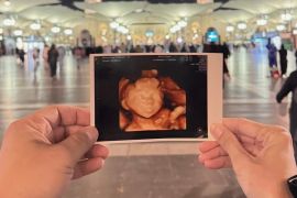 Rizal Armada sampaikan kabar duka, putri tercinta meninggal dalam kandungan