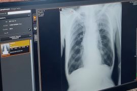 Dinkes Madiun ajak warga antisipasi super flu