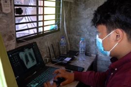 Percepat temuan kasus TBC Sulsel, Kemenkes beri bantuan alat rontgen