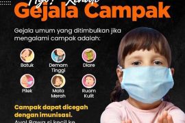 Lindungi nakes-named, Kemenkes keluarkan SE waspada campak