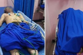 Empat pekerja tewas di Jagakarsa, polisi periksa mandor dan pemilik gedung