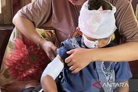 32 warga Cianjur kena gigit hewan liar, kasus terakhir akibat serangan monyet liar