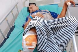 Seorang warga OKU alami luka serius, diserang beruang saat bekerja di kebun karet