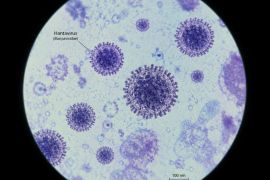 Waspada virus hanta, ini gejala dan langkah pencegahannya