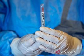 CDC tetapkan wabah hantavirus di kapal pesiar level darurat 3