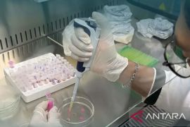 BKHIT Maluku uji brucellosis 210 sampel serum sapi asal Kobisadar SBT