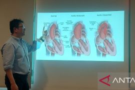 Dokter sebut nyeri dada seperti ditusuk tanda ada robekan dinding aorta