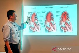 Dokter: Nyeri dada seperti ditusuk tanda ada robekan dinding aorta