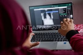 Pemkot Madiun targetkan temuan 1.312 kasus TB hingga akhir 2026